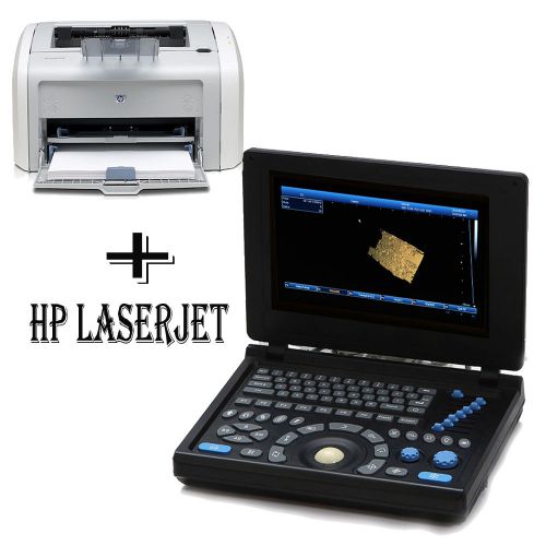 3D PC 10.4&#034; Full Digital Laptop Ultrasound Scanner Convex + HP LaserJet printer