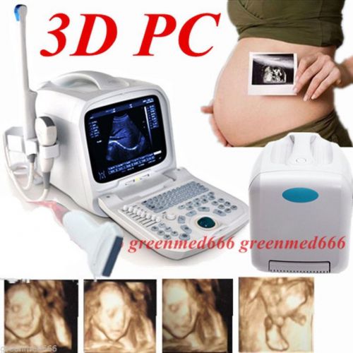 3d pc platform ultrasound scanner +7.5mhz linear &amp;transvaginal 2 probes internet for sale