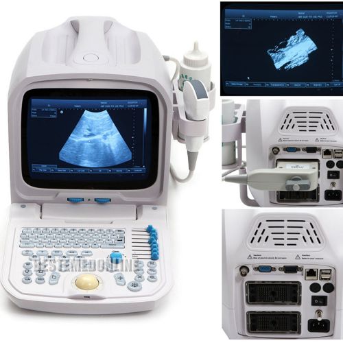 10.4 Inch 3D Portable Digital Ultrasound Scanner Machine PC 3.5MHz Convex Probe