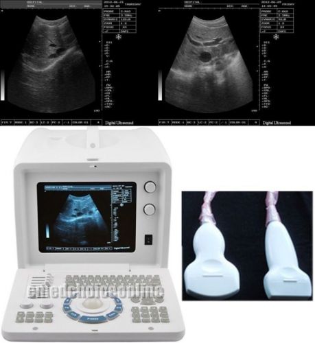 +free 3d digital portable ultrasound scanner b ultrasonic machine+convex  ca for sale