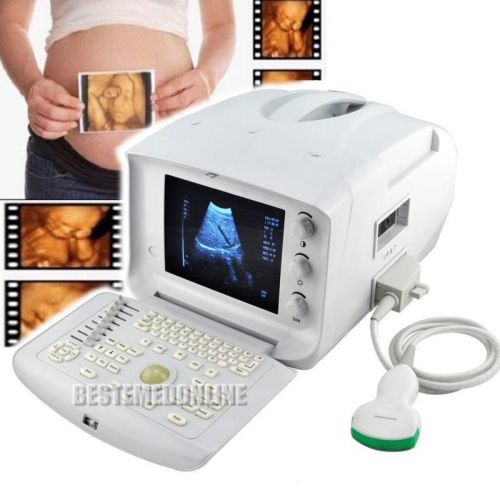 2015 NEW A Portable Ultrasound Scanner w Convex probe used in hospital clinic 3D