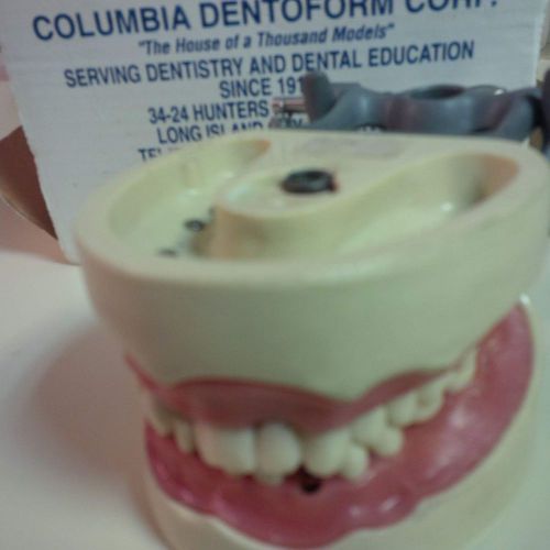 Columbia Dentoform Model