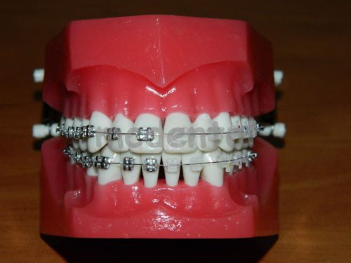 DENTOFORM ORTHODONTIC ADULT BRACES TYPODONT DEMOSTRATION MODEL TEETH