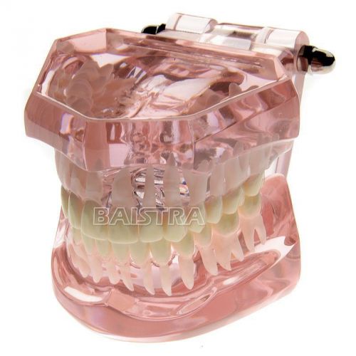 Dental Lingual Orthodontics inside bracket Demonstration Teach Teeth Model 3004