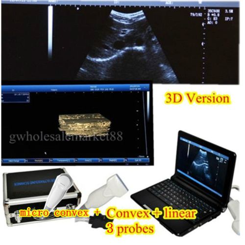3D Digital Laptop Ultrasound Scanner Machine Convex + micro convex + Linear+3PRO