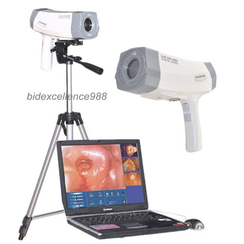 Digital electronic colposcope sony camera 800,000 pixels rcs-400 ce fda approved for sale