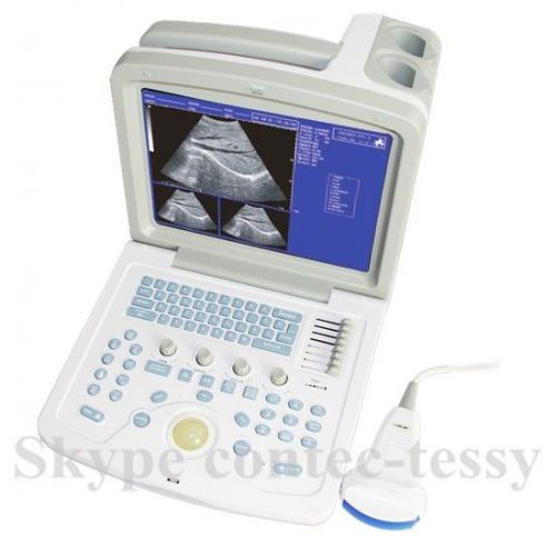 New portable ultrasound scanner 3.5mhz convex probe cms600b3+3yrs warranty,ce for sale
