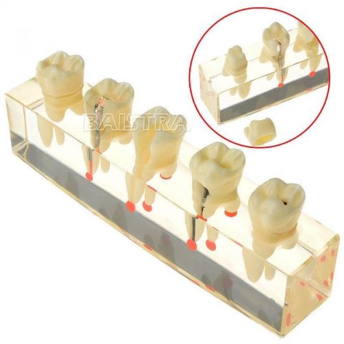 1 Kit Dental Teeth Study Teaching Model Endodontic Treatment Demonstration #4012