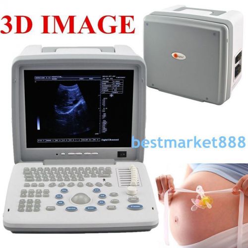 CE FDA HOT Full Digital Portable Ultrasound Scanner With Convex Vaginal Probe 3D