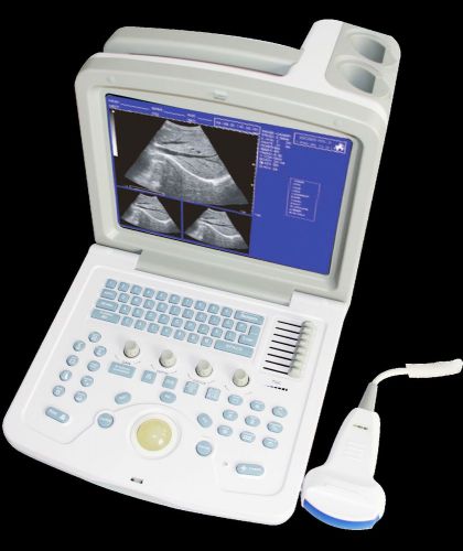 sales,CMS600B-3,CE ,Digital Portable Ultrasound Scanner Machine with two Probe