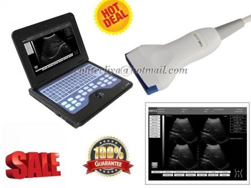 Laptop Ultrasound Diagnostic Scanner machine+7.5MHz Linear Probe,10.1 inch TFT
