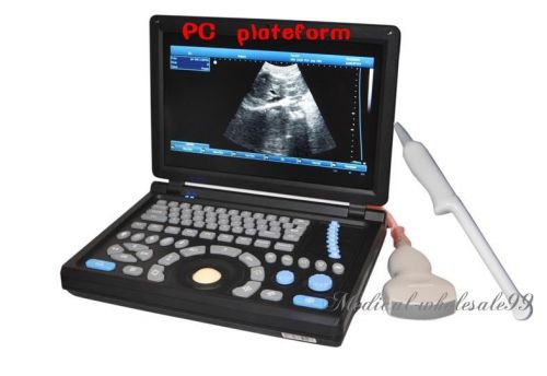In 3d digital laptop ultrasound scanner/machine pc + convex &amp; transvaginal probe for sale