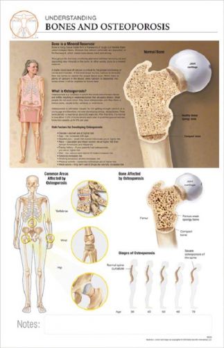 11 x 17 Post-It Disease Chart:BONES &amp; OSTEOPOROSIS