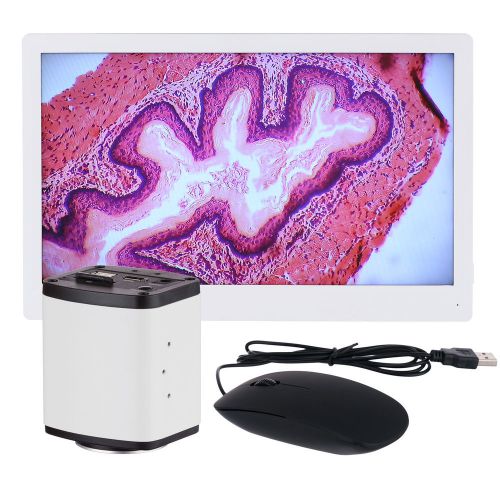 Amscope hd1080a-hdm 1080p hdmi microscope c-mount camera + hd monitor for sale