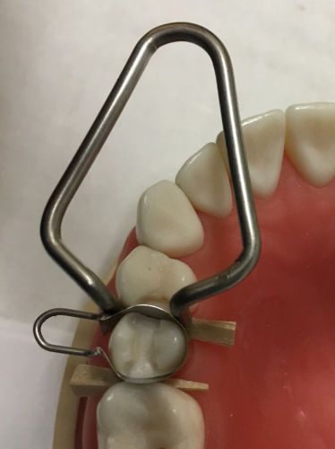 U dental matrix bands / retainers premolars  for composit and amalgam / matrices for sale