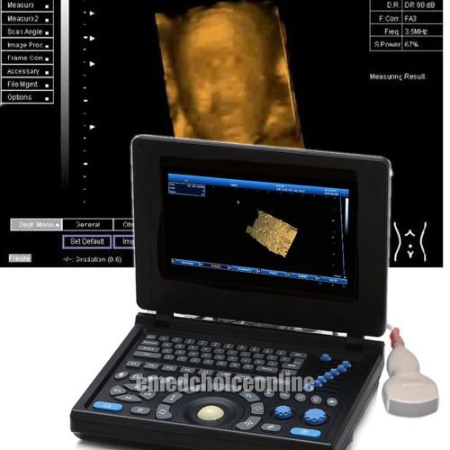 3d pc plateform notebook digital laptop ultrasound scanner with convex probes for sale