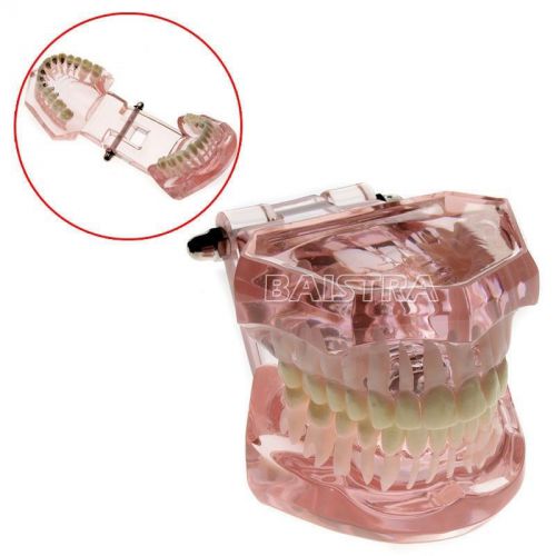 Dental Lingual Orthodontics inside bracket Demonstration Teach Teeth Model 3004