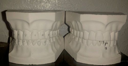 Porcelain Dental Teeth Mold Study Dental School