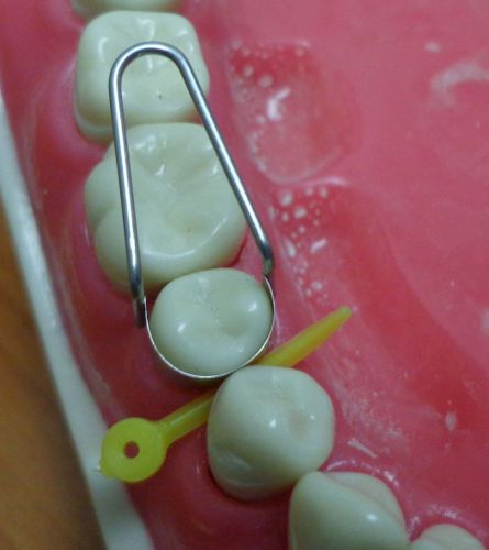 U Dental Matrix Bands retainers PRIMARY MOLARS / SHORT PREMOLARS 3/16&#034;/matrices