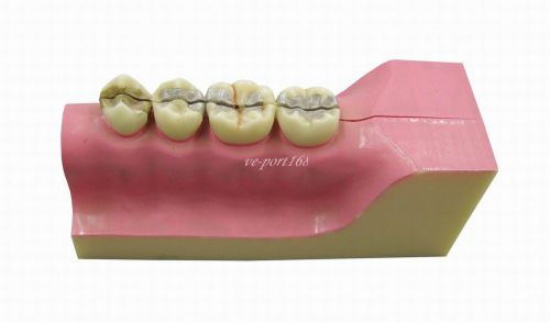 1Pc New Dental Molar Cross Section Teeth Study Model G115 (ve)