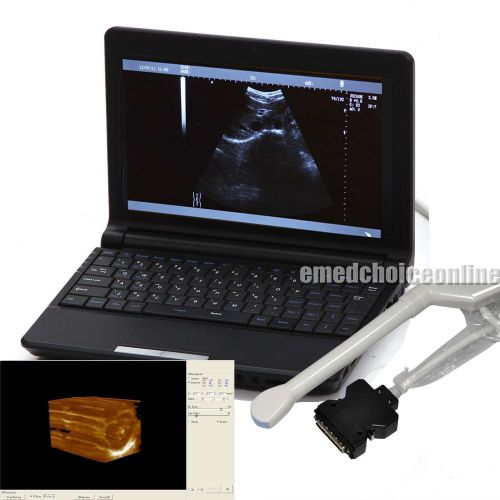 Portable 3D+++ Laptop Ultrasound machine Scanner+6.5MHz transvaginal probe US