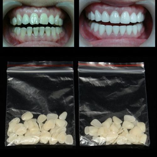 2Bags Quality Dental Materials Porcelain Upper Film for Temporary Crown Patch