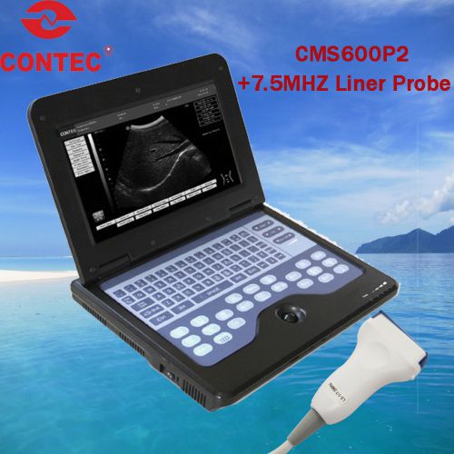 Sale! b-ultrasound scanner ultrasound diagnostic + 7.5mhz liner probe for sale