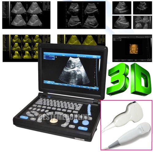 NEW 3D! PC Full Digital Laptop Ultrasound Scanner LAPTOP Convex Micro-convex * 2