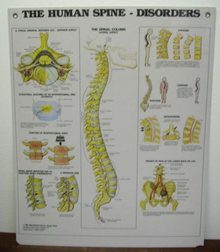 Laminated Anatomical Wall Chart &#034; The Human Spine Disorders&#034;