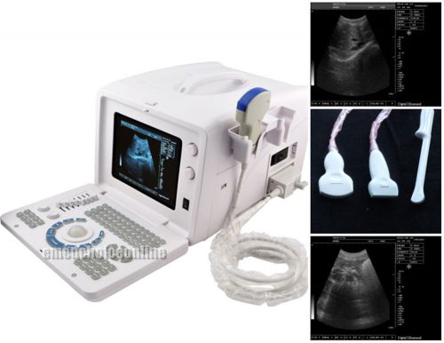 +3D* Portable Full Digital Ultrasound Scanner Machine +Convex TV Linear 3 Probes