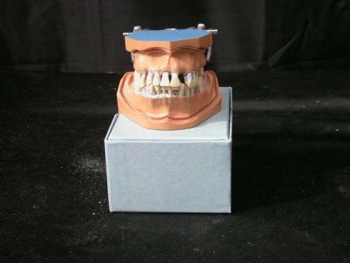 Columbia Dentiform Articulating Model W / Removeable Teeth #6 Many Missing Teeth