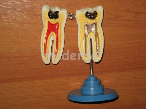 NEW MODEL GIANT MOLAR ANATOMICAL TOOTH DENTISTRY