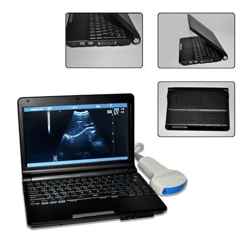 10.1-inch lcd notebook ultrasound machine scanner +convex probe/transducer for sale