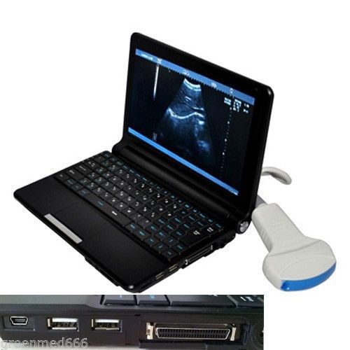 New Full Digital Ultrasound Scanner/Machine Laptop/portable +Convex probe