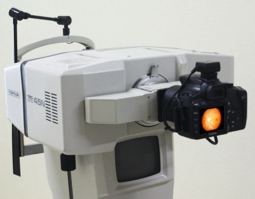 Digital upgrade kit for trc-45n,trc-45an retinal camera for sale
