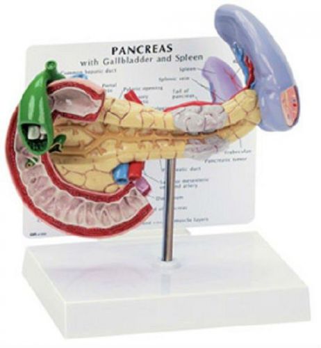 NEW Anatomical Diseased Pancreas Gallbladder Spleen
