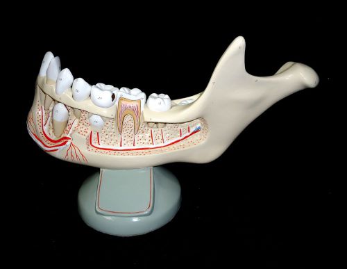 Denoyer Geppert A86 Lower Jaw of Preadolescent Removable Teeth Anatomical Model