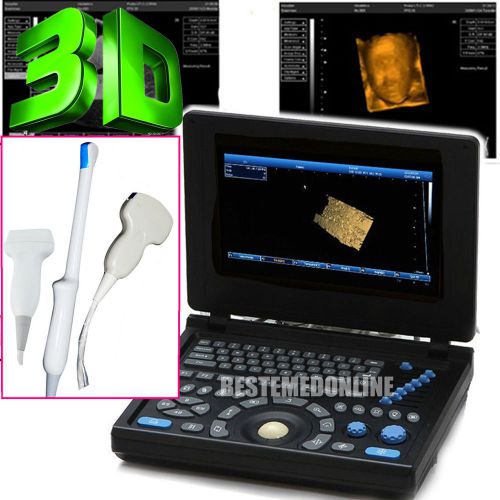 Hot! 3d *pc full digital laptop ultrasound scanner convex vaginal linear 3-probe for sale