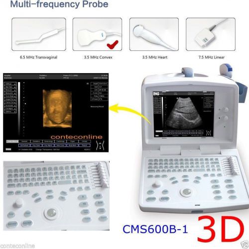 3D Full Digital Portable Ultrasound Scanner,3.5Mhz Convex Probe,can change probe