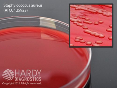 Blood Agar Dishes, Pack of 10, Petri Dishes 15x100mm