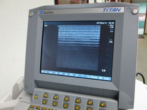 Sonosite titan ultrasound with l38 probe or hst probe for sale