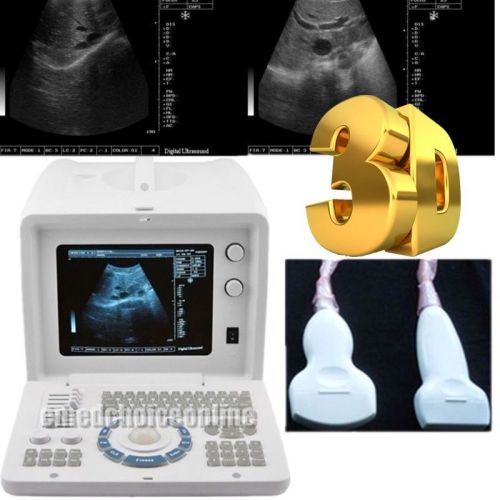 SALE 39% OFF!!! 3D Digital Ultrasound Scanner + Convex &amp; Linear 2 probes+ CA