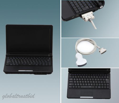 Portable notebook laptop ultrasound machine scanner system digital+convex probe for sale