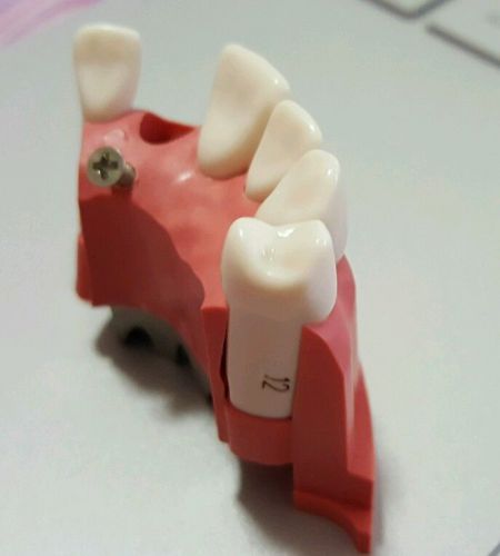 Acadental modupro quality replacement modules