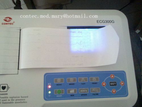Ce approved,3-channel 12 lead color ecg ekg machine w pc software with printer for sale