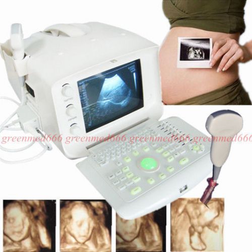 2015 version portable ultrasound scanner /machine with 3.5mhz convex probe for sale