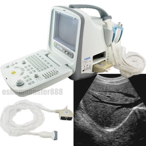Chison Portable Ultrasound Scanner Linear Probe Muskuloskeletal diagnosis MSK
