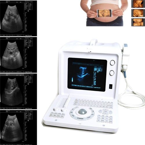 New digital ultrasound machine scanner system 3.5 mhz convex probe free 3d for sale