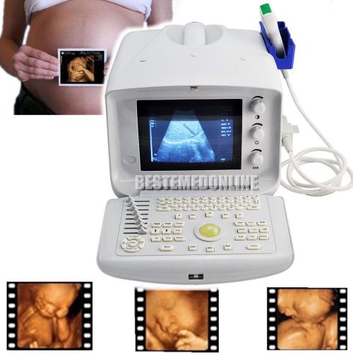 FDA Digital Portable diagnose Ultrasound Scanner machine convex+ 3D software US