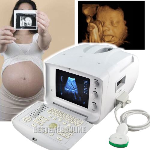 CE Digital Portable diagnose Ultrasound Scanner machine convex+ FREE 3D software